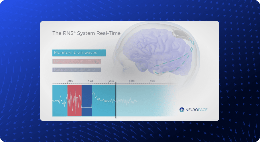 neuropace customer video